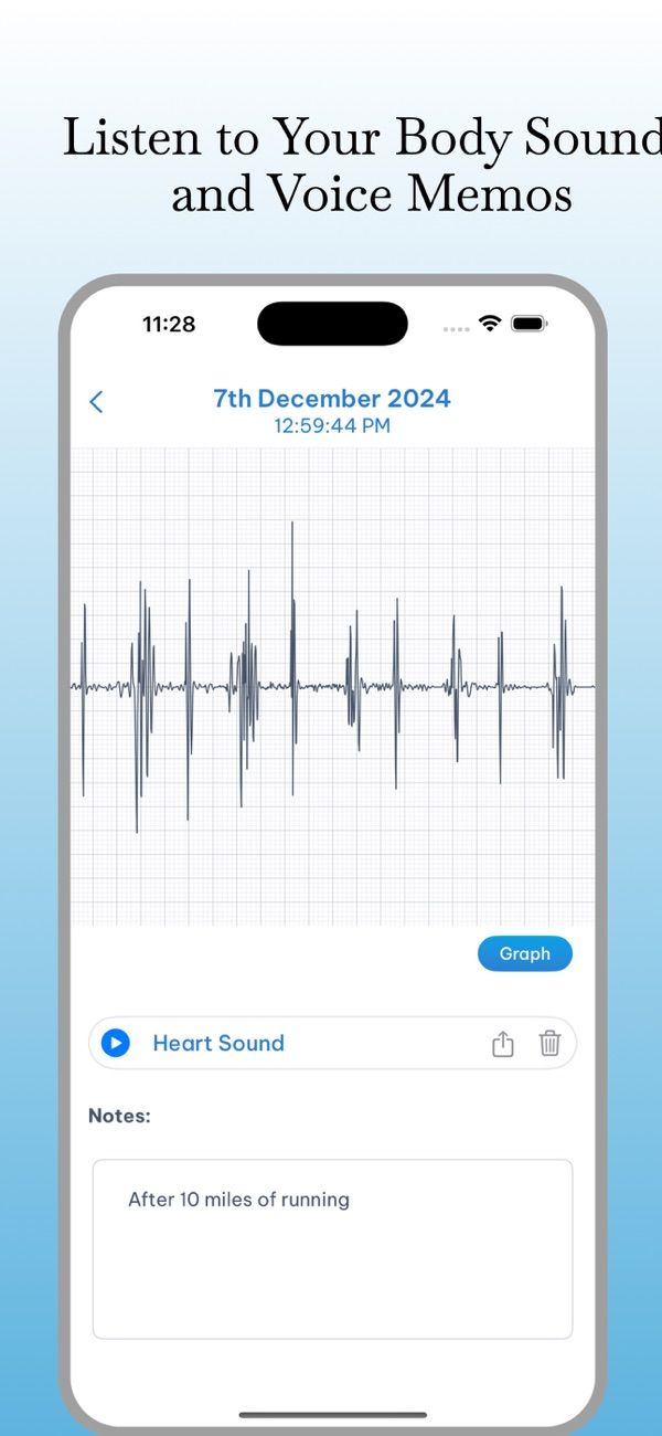 Remotex Note recording a heart sound
